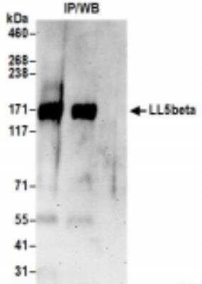 <b>Biological Strategies Validation. </b>Immunoprecipitation: PHLDB2 Antibody [NBP2-36546] - Samples: Whole cell lysate (0.5 or 1.0 mg per IP reaction; 20% of IP loaded) from 293T cells prepared using NETN lysis buffer. For blotting immunoprecipitated LL5beta, it was used at 1 ug/ml. Detection: Chemiluminescence with an exposure time of 3 minutes.
