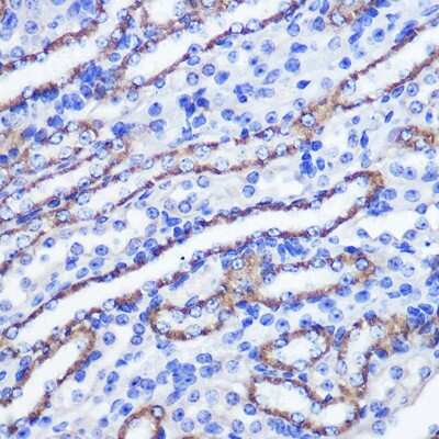 Immunohistochemistry-Paraffin: PHLPP Antibody [NBP2-93296] - Immunohistochemistry of paraffin-embedded mouse kidney using PHLPP Rabbit pAb (NBP2-93296) at dilution of 1:100 (40x lens). Perform microwave antigen retrieval with 10 mM PBS buffer pH 7.2 before commencing with IHC staining protocol.