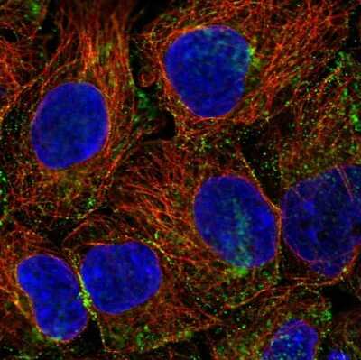 Immunocytochemistry/ Immunofluorescence PHLPP2 Antibody - BSA Free