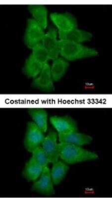 Immunocytochemistry/Immunofluorescence: PHLPP2 Antibody [NBP2-19803] - Analysis of paraformaldehyde-fixed A431, using antibody at 1:500 dilution.