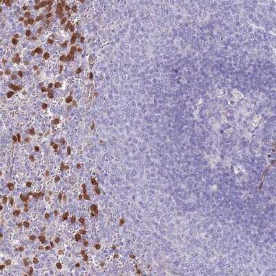 Immunohistochemistry-Paraffin: PHLPP2 Antibody [NBP2-13757] - Staining of human spleen shows strong positivity in a subset of cells in the red pulp.