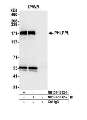 PHLPP2 Antibody [NB100-1812] - Detection of human PHLPPL by western blot of immunoprecipitates. Samples: Whole cell lysate (1.0 mg per IP reaction; 20% of IP loaded) from HeLa cells prepared using NETN lysis buffer. Antibodies: Affinity purified Rabbit anti-PHLPPL antibody NB100-1812 (lot NB100-1812-2) used for IP at 6 ug per reaction. PHLPPL was also immunoprecipitated by a previous lot of this antibody (lot NB100-1812-1). For blotting immunoprecipitated PHLPPL, NB100-1812 was used at 0.04 ug/ml. Chemiluminescence with an exposure time of 10 seconds.