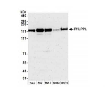 Western Blot PHLPP2 Antibody