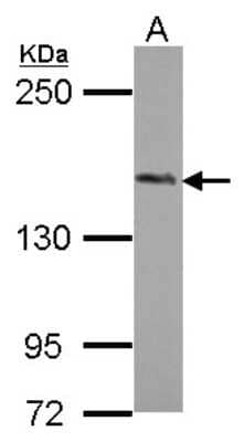 Western Blot: PHLPP2 Antibody [NBP2-19803] - Sample (50 ug of whole cell lysate) A: Mouse Brain, 5% SDS PAGE gel, diluted at 1:2000.