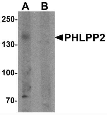 Western Blot: PHLPP2 Antibody [NBP2-81874] - Analysis of PHLPP2 in SW480 cell lysate with PHLPP2 antibody at 1 ug/ml in (A) the presence and (B) absence of blocking peptide.