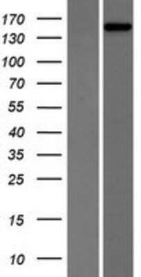 Western Blot: PHLPP2 Overexpression Lysate (Adult Normal) [NBP2-07231] Left-Empty vector transfected control cell lysate (HEK293 cell lysate); Right -Over-expression Lysate for PHLPP2.