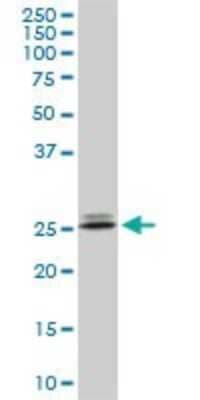 Western Blot: PHOSPHO1 Antibody (1A11) [H00162466-M10] - Analysis of PHOSPHO1 expression in PC-12 (Cat # L012V1).
