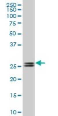 Western Blot: PHOSPHO1 Antibody (1A11) [H00162466-M10] - Analysis of PHOSPHO1 expression in Jurkat (Cat # L017V1).