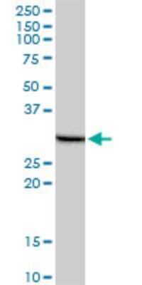 Western Blot: PHOSPHO1 Antibody (1A11) [H00162466-M10] - Analysis of PHOSPHO1 expression in human liver.