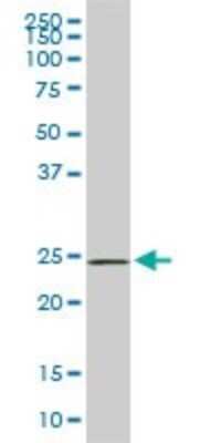 Western Blot: PHOSPHO1 Antibody (4B2) [H00162466-M04] - Analysis of PHOSPHO1 expression in PC-12 (Cat # L012V1).