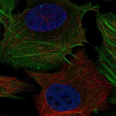 Immunocytochemistry/Immunofluorescence: PHOSPHO1 Antibody [NBP2-68826] - Staining of human cell line U-2 OS shows localization to actin filaments. Antibody staining is shown in green.