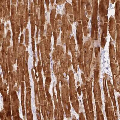 Immunohistochemistry: PHOSPHO1 Antibody [NBP2-49070] - Staining of human heart muscle shows strong cytoplasmic positivity in myocytes.