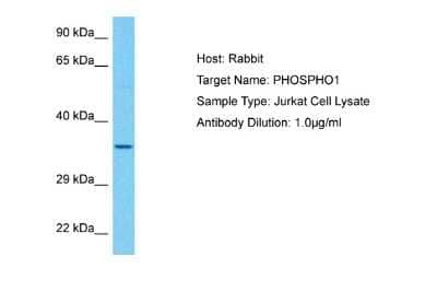 Western Blot: PHOSPHO1 Antibody [NBP1-98553] - Host: Rabbit. Target Name: PHOSPHO1. Sample Tissue: Human Jurkat Whole Cell. Antibody Dilution: 1ug/ml