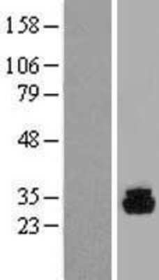 Western Blot: PHOSPHO1 Overexpression Lysate (Adult Normal) [NBP2-04955] Left-Empty vector transfected control cell lysate (HEK293 cell lysate); Right -Over-expression Lysate for PHOSPHO1.