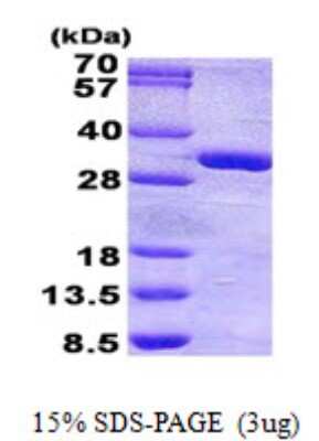SDS-Page: PHOSPHO1 Protein [NBP2-23326]