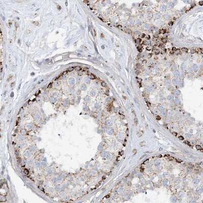 Immunohistochemistry-Paraffin PHOSPHO2 Antibody - BSA Free