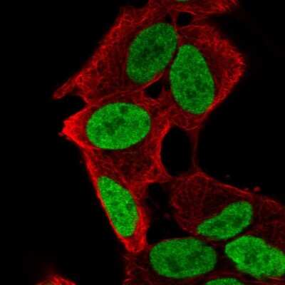 Immunocytochemistry/Immunofluorescence: PHOX2A Antibody [NBP2-56644] - Staining of human cell line SH-SY5Y shows localization to nucleus.