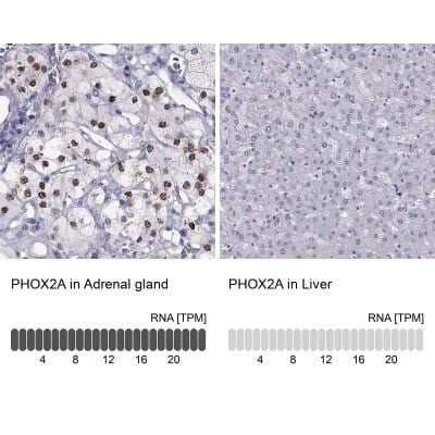 <b>Orthogonal Strategies Validation. </b>Immunohistochemistry-Paraffin: PHOX2A Antibody [NBP2-62721] - Analysis in human adrenal gland and liver tissues using Anti-PHOX2A antibody. Corresponding PHOX2A RNA-seq data are presented for the same tissues.