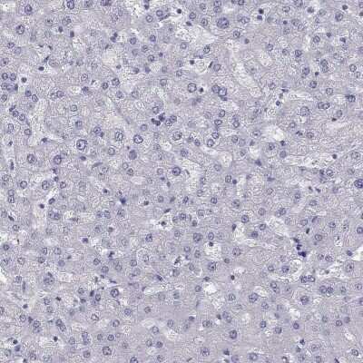 Immunohistochemistry-Paraffin: PHOX2A Antibody [NBP2-62721] - Staining of human liver shows low expression as expected.