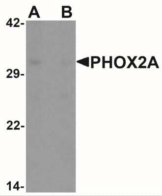 Western Blot: PHOX2A Antibody [NBP2-41169] - Western blot analysis of PHOX2A in rat brain tissue lysate with PHOX2A antibody at 1 ug/ml in (A) the absence and (B) the presence of blocking peptide.