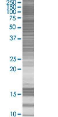 PHOX2A Overexpression Lysate (Denatured) [H00000401-T01]