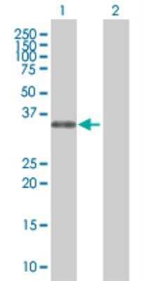 Western Blot: PHOX2A Overexpression Lysate (Denatured) [H00000401-T01] - Lane 1: PHOX2A transfected lysate (29.7 KDa) Lane 2: Non-transfected lysate.