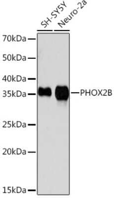 Western Blot: PHOX2B Antibody (4W5J8) [NBP3-16643] - Western blot analysis of extracts of various cell lines, using PHOX2B Rabbit mAb (NBP3-16643) at 1:1000 dilution. Secondary antibody: HRP Goat Anti-Rabbit IgG (H+L) at 1:10000 dilution. Lysates/proteins: 25ug per lane. Blocking buffer: 3% nonfat dry milk in TBST. Detection: ECL Basic Kit. Exposure time: 3min.