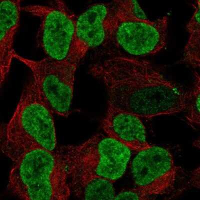 Immunocytochemistry/Immunofluorescence: PHOX2B Antibody [NBP2-68991] - Staining of human cell line SH-SY5Y shows localization to nucleoplasm.