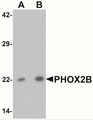 Western Blot: PHOX2B Antibody [NBP2-41179] - Western blot analysis of PHOX2B in 293 cell lysate with PHOX2B antibody at (A) 1 and (B) 2 ug/mL.