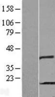 Western Blot: PHPT1 Overexpression Lysate (Adult Normal) [NBL1-14372] Left-Empty vector transfected control cell lysate (HEK293 cell lysate); Right -Over-expression Lysate for PHPT1.