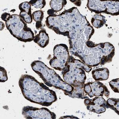 Immunohistochemistry-Paraffin: PHRF1 Antibody [NBP1-82903] - Staining of human placenta shows strong cytoplasmic positivity in trophoblastic cells.