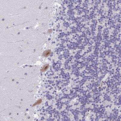 Immunohistochemistry-Paraffin: PHRF1 Antibody [NBP2-38979] - Staining of human cerebellum shows moderate nuclear and cytoplasmic positivity in Purkinje cells.