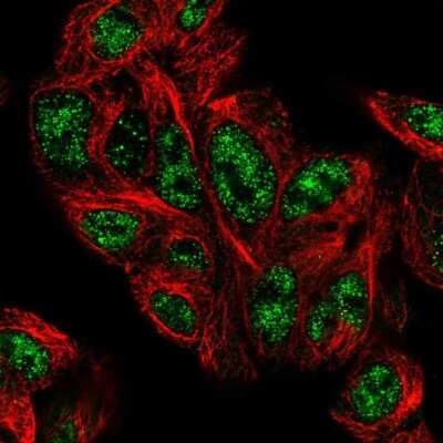 Immunocytochemistry/Immunofluorescence: PHYHD1 Antibody [NBP1-81187] - Staining of human cell line Hep G2 shows positivity in nucleus but excluded from the nucleoli. Antibody staining shown in green.