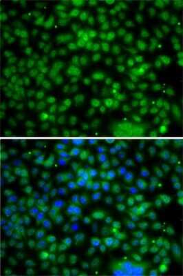 Immunocytochemistry/Immunofluorescence: PHYHD1 Antibody [NBP2-93015] - Analysis of A-549 cells using PHYHD1 . Blue: DAPI for nuclear staining.
