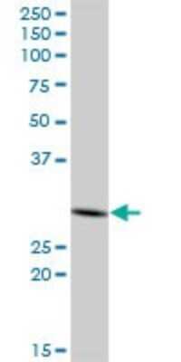 Western Blot PHYHD1 Antibody - Azide and BSA Free