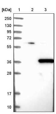 Western Blot PHYHD1 Antibody - BSA Free