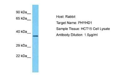 Western Blot: PHYHD1 Antibody [NBP2-85473] - Host: Rabbit. Target Name: PHYHD1. Sample Type: HCT15 Whole Cell lysates. Antibody Dilution: 1.0ug/ml