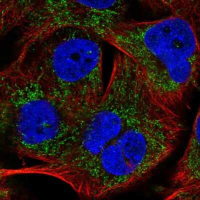 Immunocytochemistry/Immunofluorescence: PHYHIP Antibody [NBP2-57296] - Staining of human cell line SK-MEL-30 shows localization to mitochondria.