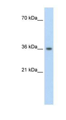 Western Blot: PHYHIP Antibody [NBP1-56325] - Transfected 293T cell lysate, concentration 1.25ug/ml.