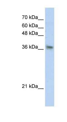 Western Blot: PHYHIP Antibody [NBP1-56336] - Transfected 293T cell lysate, concentration 0.2-1 ug/ml.