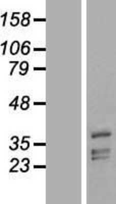 Western Blot PHYHIP Overexpression Lysate