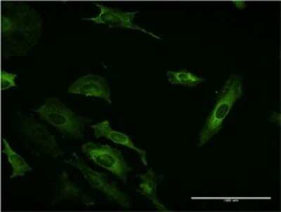 Immunocytochemistry/Immunofluorescence: PI 3-Kinase C2 beta Antibody (1H4) [H00005287-M06] - Analysis of monoclonal antibody to PIK3C2B on HeLa cell. Antibody concentration 10 ug/ml