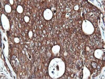 Immunohistochemistry PI 3-Kinase C2 beta Antibody (OTI3B1)