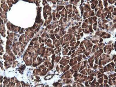 Immunohistochemistry PI 3-Kinase C2 beta Antibody (OTI3B1)