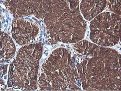 Immunohistochemistry PI 3-Kinase C2 beta Antibody (OTI3B1)