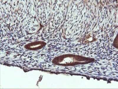Immunohistochemistry: PI 3-Kinase C2 beta Antibody (3B1) [NBP2-46402] - Analysis of Human endometrium tissue. (Heat-induced epitope retrieval by 10mM citric buffer, pH6.0, 120C for 3min)