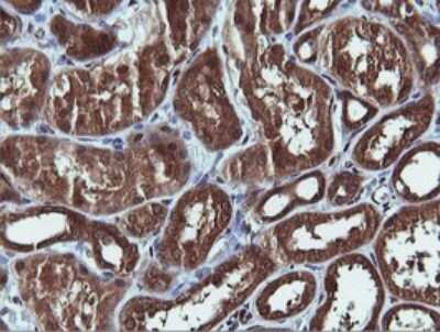 Immunohistochemistry: PI 3-Kinase C2 beta Antibody (3B1) [NBP2-46402] - Analysis of Human Kidney tissue. (Heat-induced epitope retrieval by 10mM citric buffer, pH6.0, 120C for 3min)