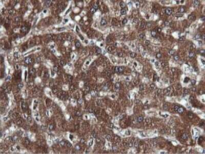 Immunohistochemistry: PI 3-Kinase C2 beta Antibody (3B1) [NBP2-46402] - Analysis of Human liver tissue. (Heat-induced epitope retrieval by 10mM citric buffer, pH6.0, 120C for 3min)