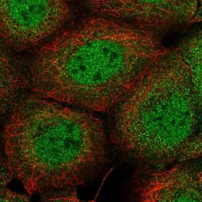 Immunocytochemistry/Immunofluorescence: PI 3-Kinase C2 beta Antibody [NBP2-58352] - Staining of human cell line A-431 shows localization to nucleoplasm & cytosol.