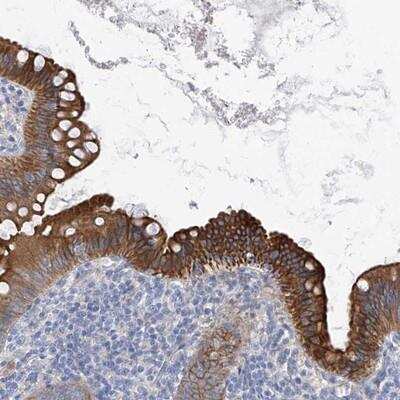Immunohistochemistry PI 3-Kinase C2 beta Antibody - BSA Free